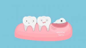 Wisdom Teeth Extraction: A Guide to Oral Health