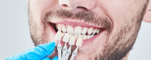Cost of Porcelain Veneers: What You Need to Know